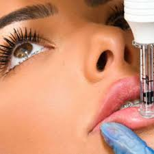 Choosing the Right Facial Filler in Singapore A Guide to Safe and Effective Results Image 4