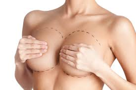 Everything You Should Know About Breast Augmentation From Consultation to Recovery image 2